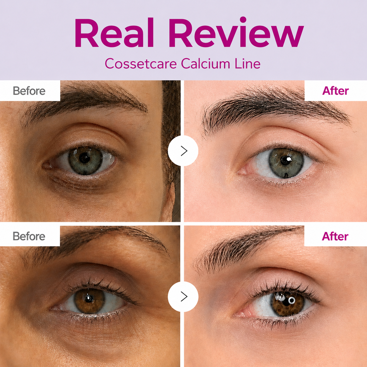 🔥LAST DAY 50% OFF!!Velcne Korean Calcium Dark Spot Eye Cream