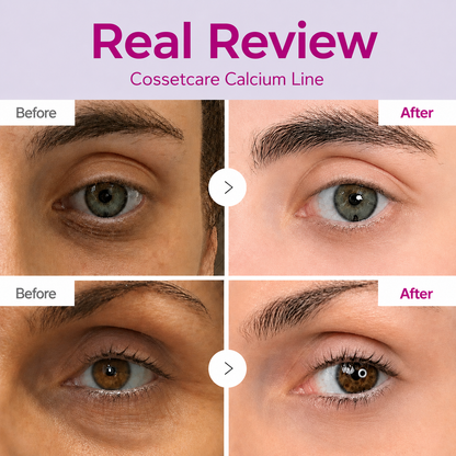 🔥LAST DAY 50% OFF!!Velcne Korean Calcium Dark Spot Eye Cream