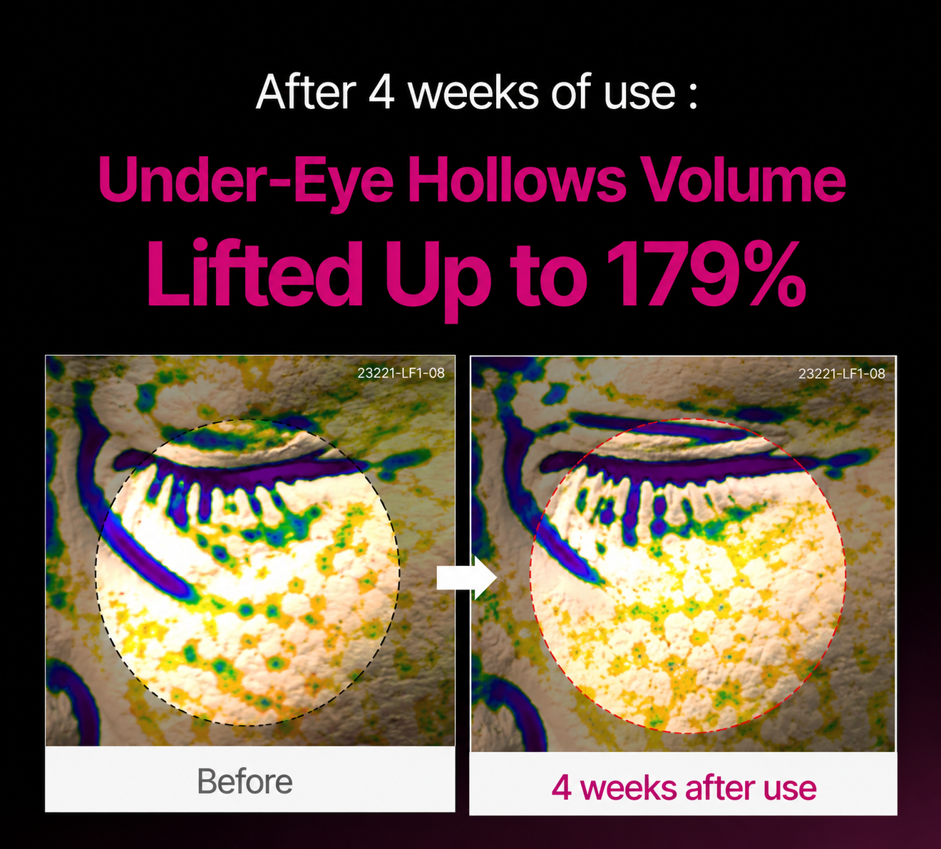 🔥LAST DAY 50% OFF!!Velcne Korean Calcium Dark Spot Eye Cream